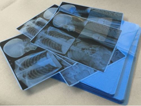 Película médica azul de inyección de tinta  (película de rayos X)